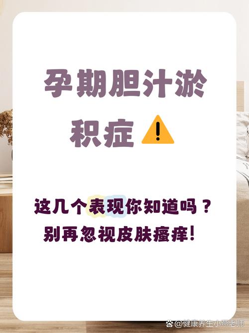 孕期胆汁淤积症究竟是什么?对母婴健康有哪些潜在风险?-第1张图片-郑州医学网 孕期胆汁淤积症究竟是什么?对母婴健康有哪些潜在风险?-第1张图片-郑州医学网