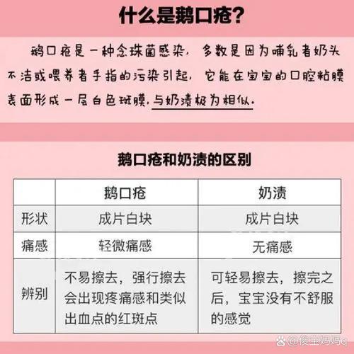 新手爸妈必看！如何科学预防新生儿鹅口疮，守护宝宝口腔健康？-第3张图片-郑州医学网