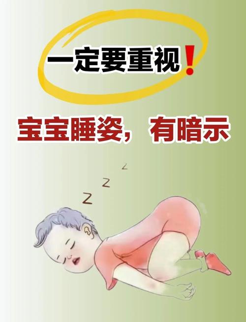 新生儿锁骨骨折后，正确的睡姿是怎样的？有哪些注意事项？-第1张图片-郑州医学网