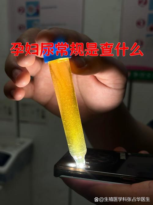 孕期尿常规检查出什么-第2张图片-郑州医学网