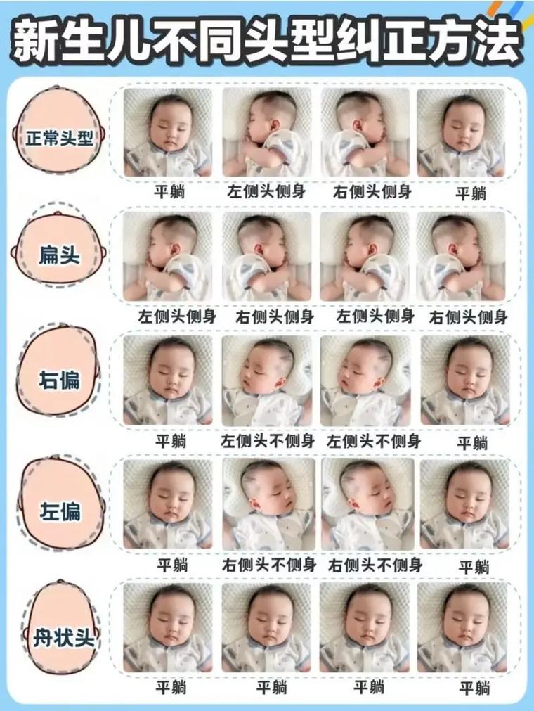 新生儿睡觉怎么睡头型？正确姿势与定型枕怎么选才科学？-第3张图片-郑州医学网