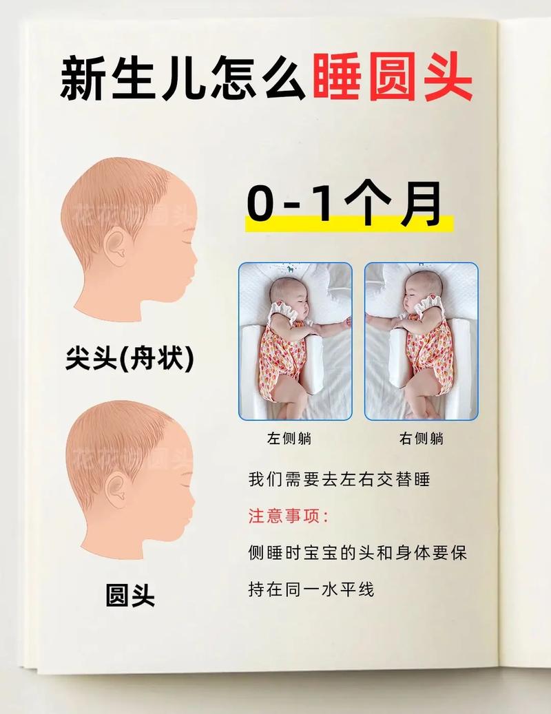 新生儿睡觉怎么睡头型？正确姿势与定型枕怎么选才科学？-第2张图片-郑州医学网