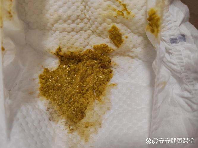 新生儿拉粑粑带血丝是上火还是肠道出问题了？-第1张图片-郑州医学网