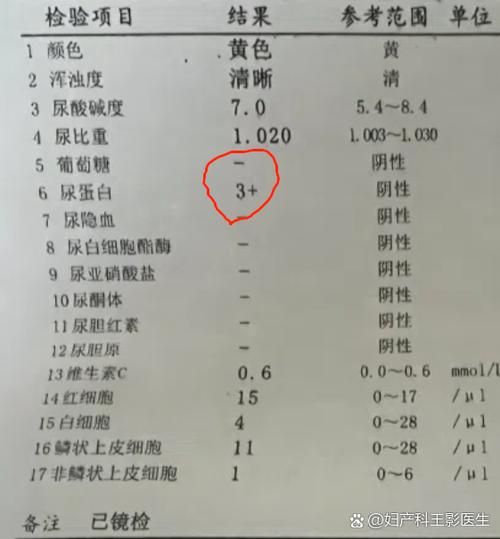 孕期尿检蛋白质弱阳性，对胎儿有影响吗？需要立即治疗吗？-第3张图片-郑州医学网