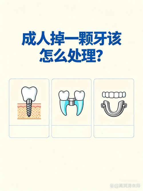 怀孕期间牙掉了怎么办-第3张图片-郑州医学网