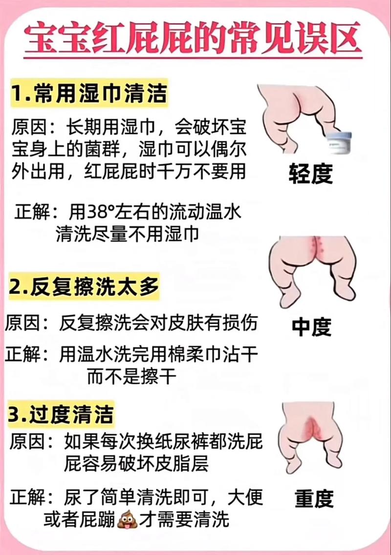 新生儿红屁屁到底该如何判断？新手爸妈必看的关键信号有哪些？-第2张图片-郑州医学网