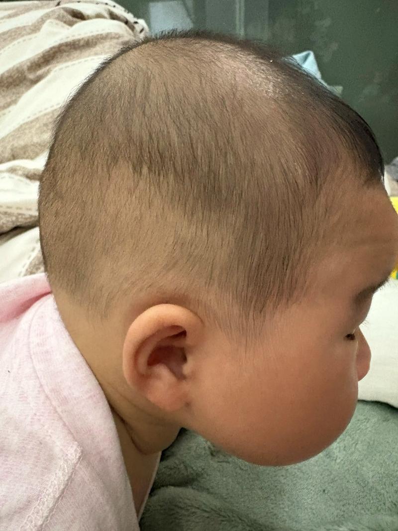 新生儿侧睡时头后仰是正常现象吗？需要干预纠正吗？-第2张图片-郑州医学网