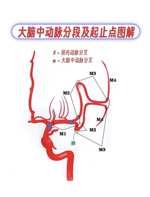 新生儿大脑前动脉阻力异常会引发哪些神经系统发育问题？-第3张图片-郑州医学网
