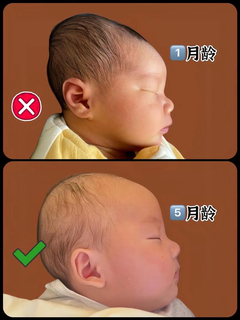 新生儿睡觉总偏向右侧是正常现象吗？需要干预纠正吗？-第2张图片-郑州医学网