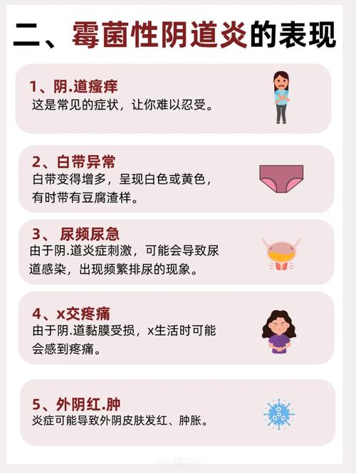孕期霉菌性阴道炎为何反复发作？对胎儿会有哪些影响？-第2张图片-郑州医学网