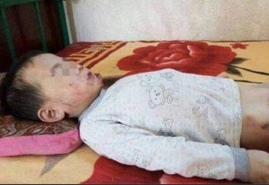 儿童铅中毒症状隐匿，后果有多严重？家长该如何早期识别与干预？-第3张图片-郑州医学网