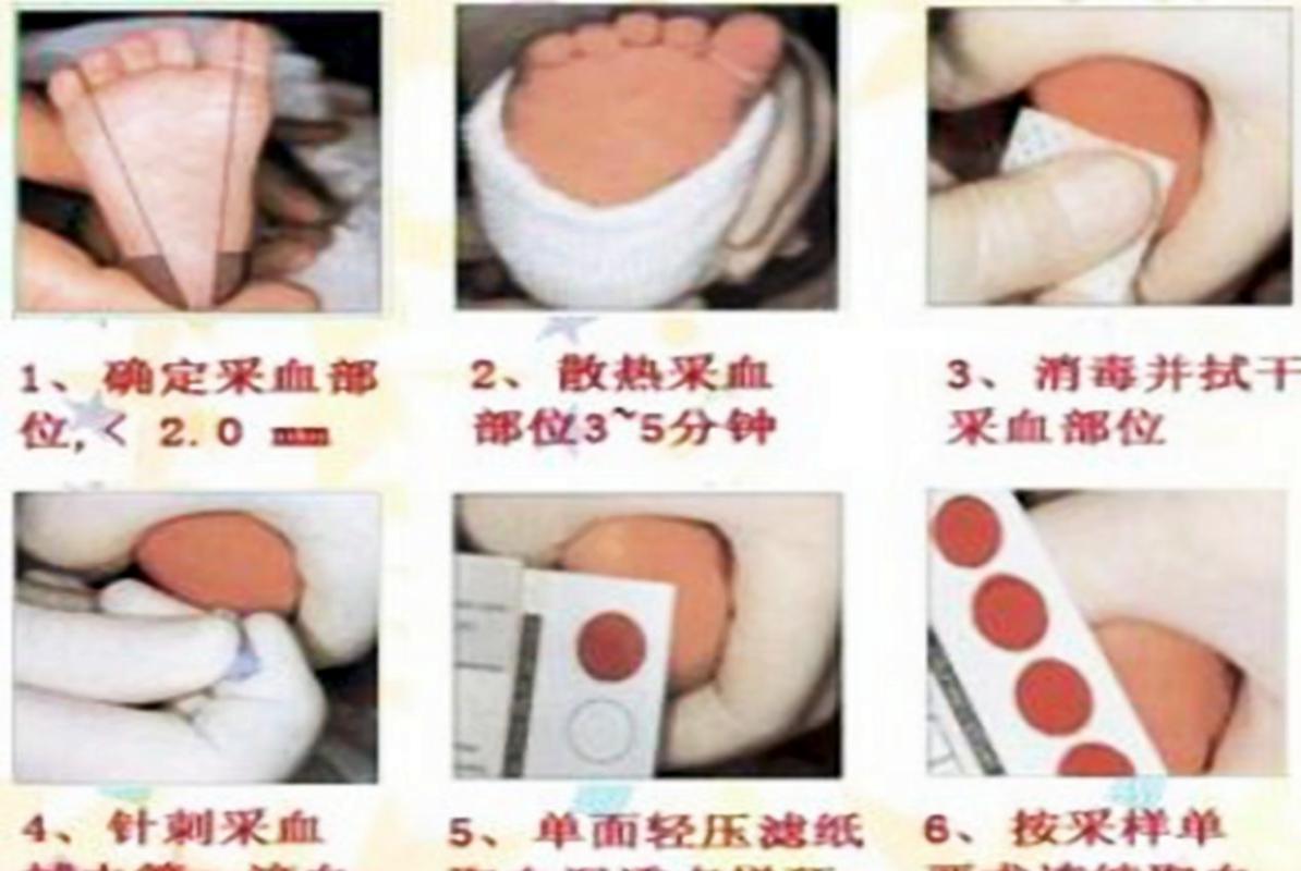 新生儿足跟血采集位置选哪里才准确且安全？-第1张图片-郑州医学网