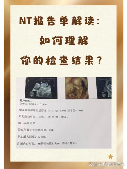 孕期检查NT到底是什么？它对胎儿健康有何重要意义？-第1张图片-郑州医学网