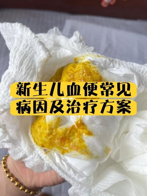 新生儿急性胃黏膜出血的诱因、诊疗要点及预后如何？-第1张图片-郑州医学网