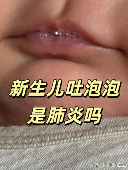 新生儿急性胃黏膜出血的诱因、诊疗要点及预后如何？-第2张图片-郑州医学网