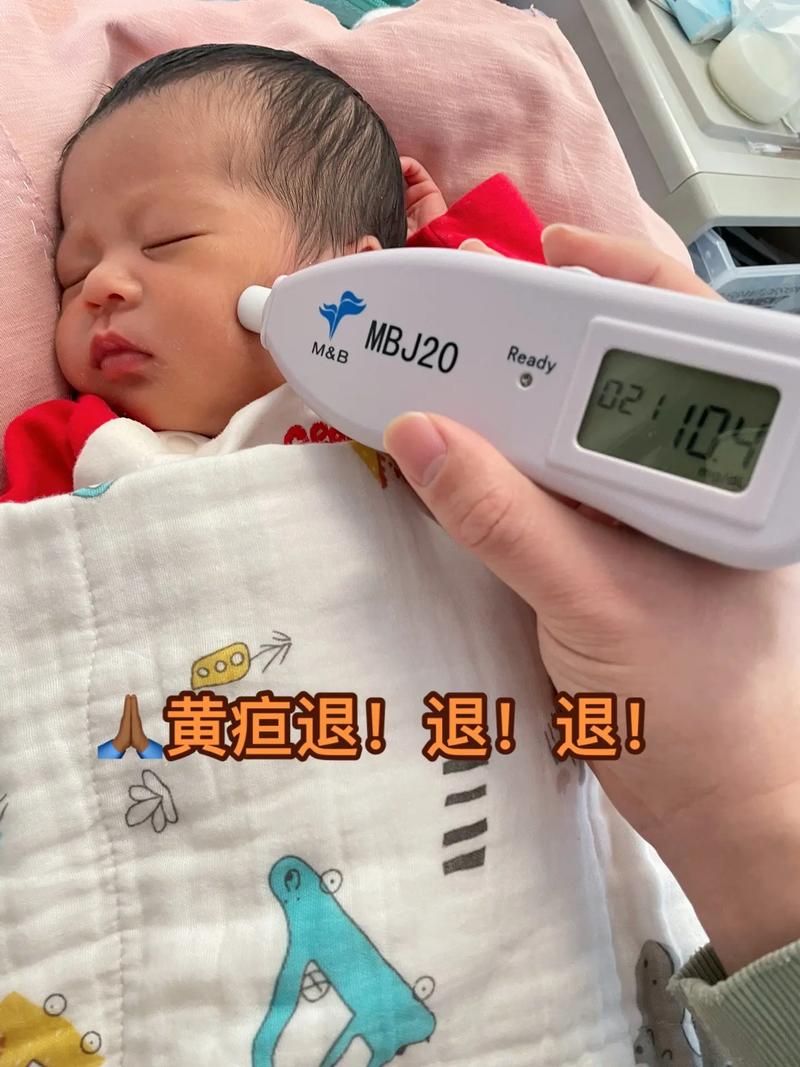 在家如何准确判断新生儿黄疸？这些方法家长需掌握！-第2张图片-郑州医学网