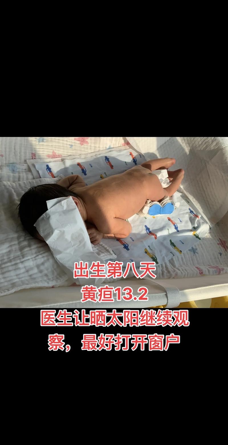 在家如何准确判断新生儿黄疸？这些方法家长需掌握！-第3张图片-郑州医学网