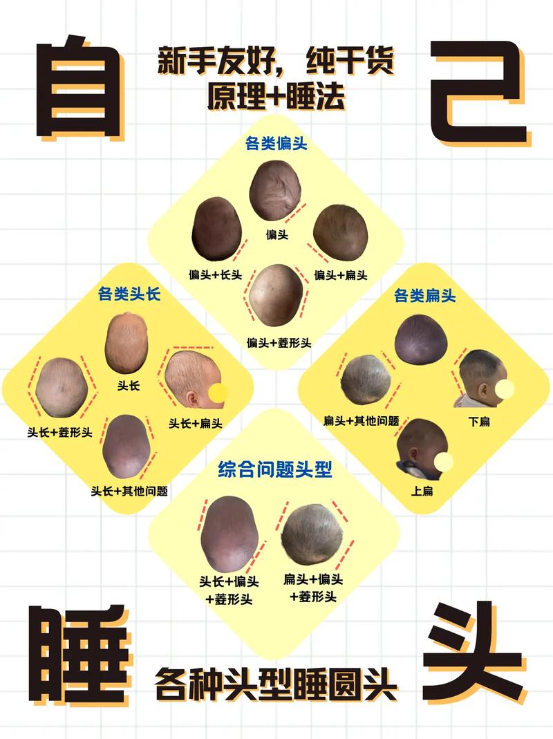 新生儿宝宝如何睡头型-第3张图片-郑州医学网