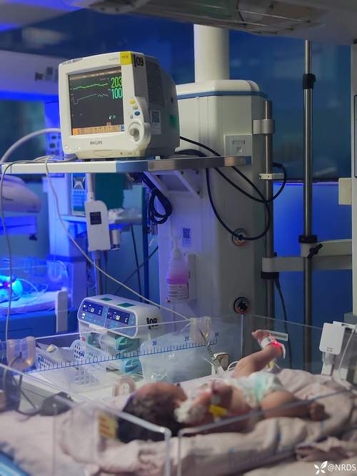 新生儿DR检查是什么?它和其他影像检查有何不同?-第1张图片-郑州医学网 新生儿DR检查是什么?它和其他影像检查有何不同?-第1张图片-郑州医学网