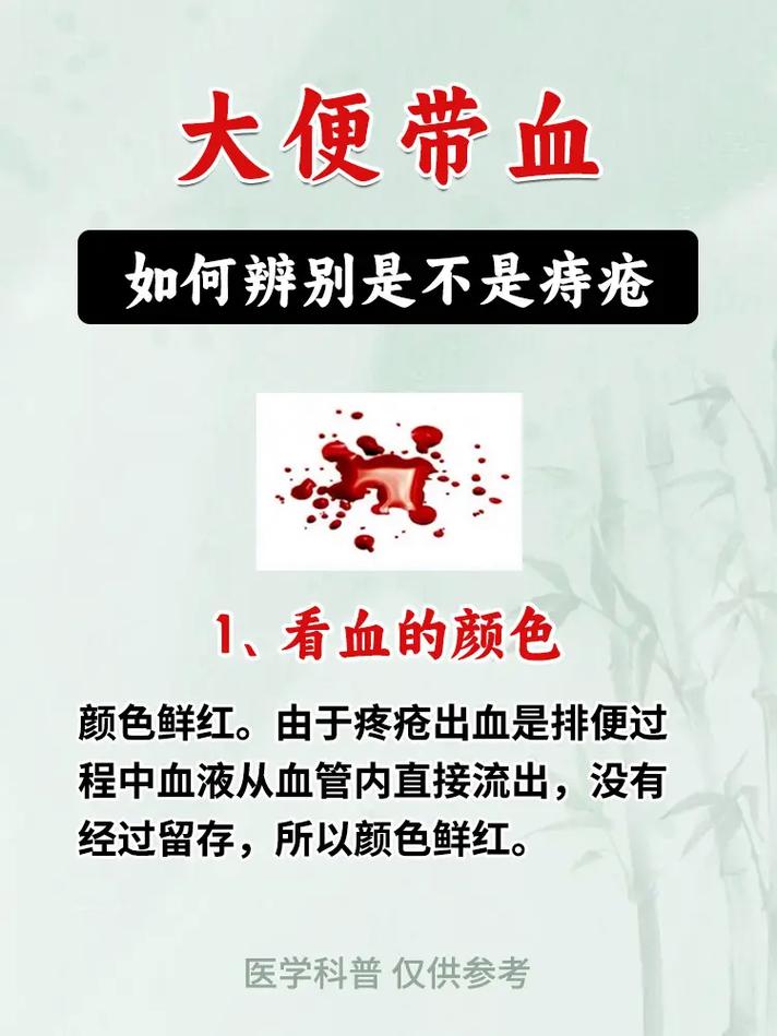 孕期大便带血是哪些原因导致的？需要立即就医吗？-第2张图片-郑州医学网