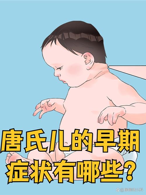 新生儿CH异常严重吗？早发现早干预对宝宝影响有多大？-第2张图片-郑州医学网
