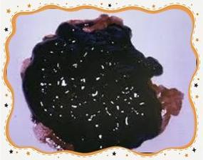 孕期大便发黑是正常现象还是身体预警？需要警惕哪些潜在健康风险？-第1张图片-郑州医学网