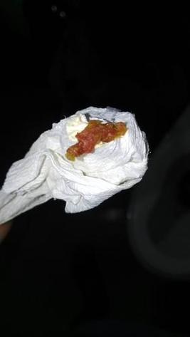 孕期大便发黑是正常现象还是身体预警？需要警惕哪些潜在健康风险？-第3张图片-郑州医学网