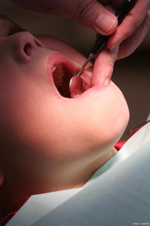 新生儿喉咙好像有东西，是正常现象还是需要紧急处理？-第2张图片-郑州医学网