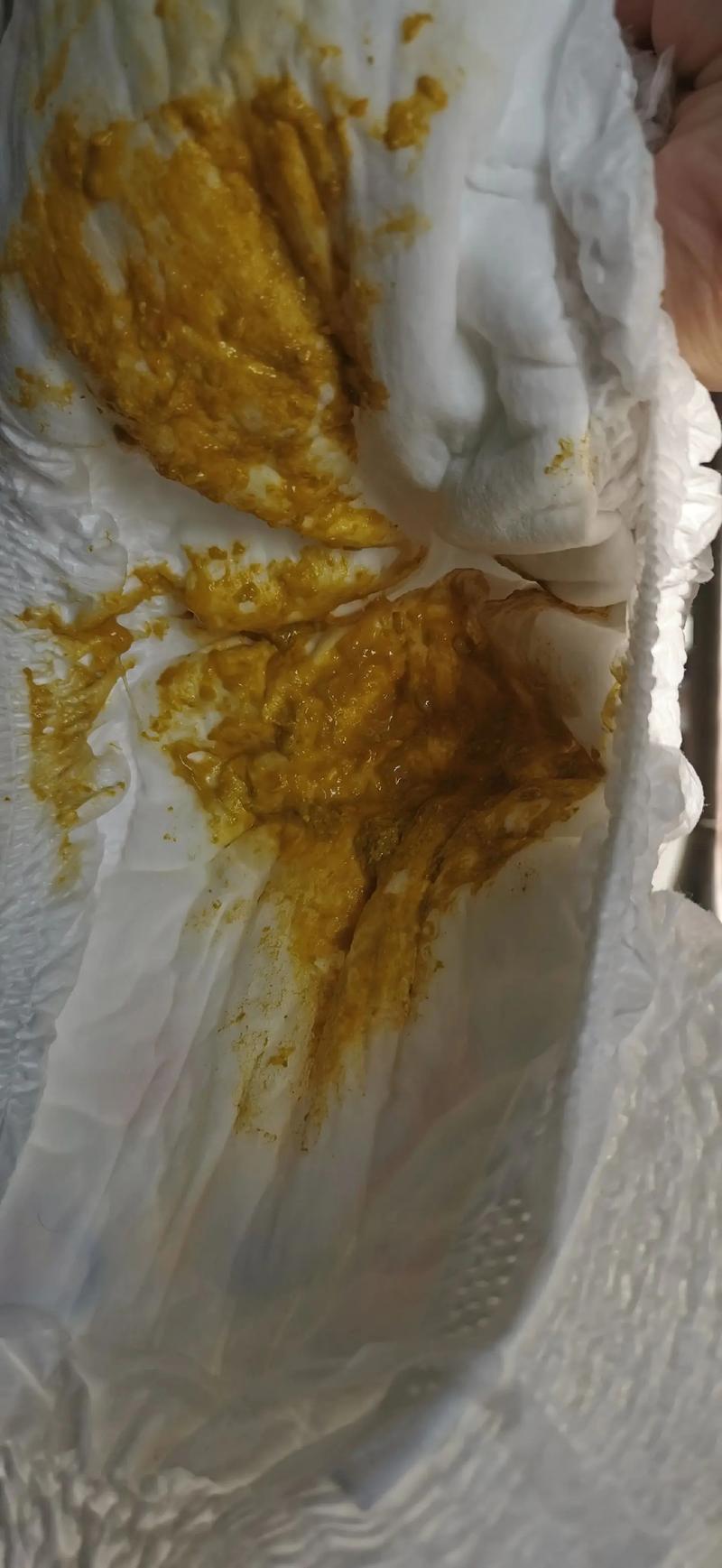 新生儿拉粑粑声音很大，是正常现象还是肠胃异常？-第2张图片-郑州医学网