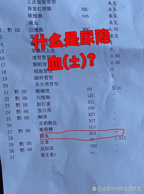 儿童尿检隐血2个加号严重吗？需要怎么治疗和复查？-第1张图片-郑州医学网