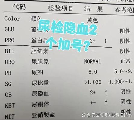 儿童尿检隐血2个加号严重吗？需要怎么治疗和复查？-第2张图片-郑州医学网