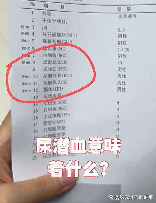 儿童尿检隐血2个加号严重吗？需要怎么治疗和复查？-第3张图片-郑州医学网