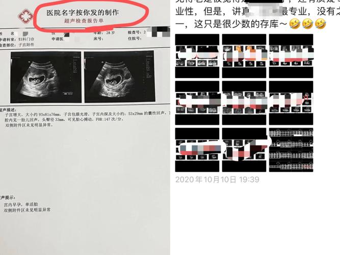孕期B超持续偏小一周，是胎儿发育迟缓还是误差？需要干预吗？-第1张图片-郑州医学网
