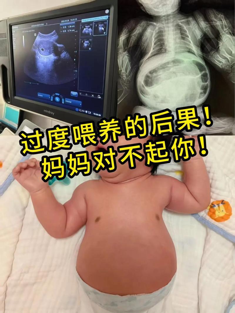 20天新生儿混合喂养，如何正确衔接奶粉与母乳避免宝宝消化不良？-第3张图片-郑州医学网