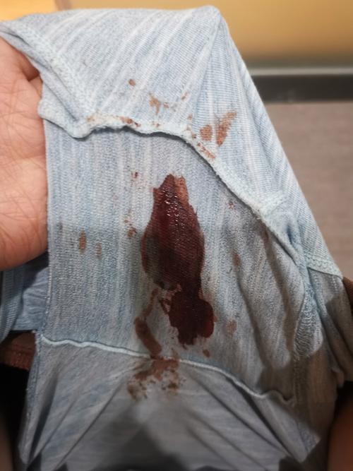 孕期一个月肚子疼流血是正常现象还是危险信号？-第1张图片-郑州医学网