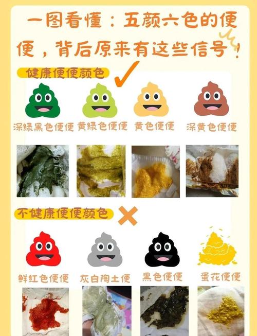 新生儿每次拉尿都带便便，是生理现象还是异常信号？-第2张图片-郑州医学网