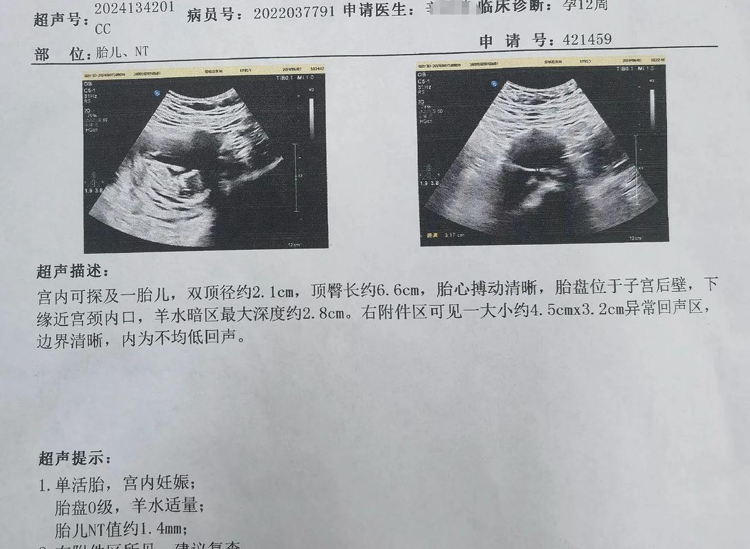 孕期三维彩超单怎么看-第1张图片-郑州医学网