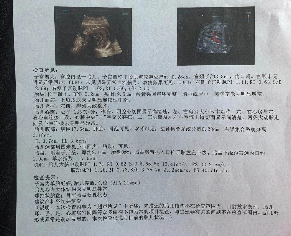孕期三维彩超单怎么看-第2张图片-郑州医学网