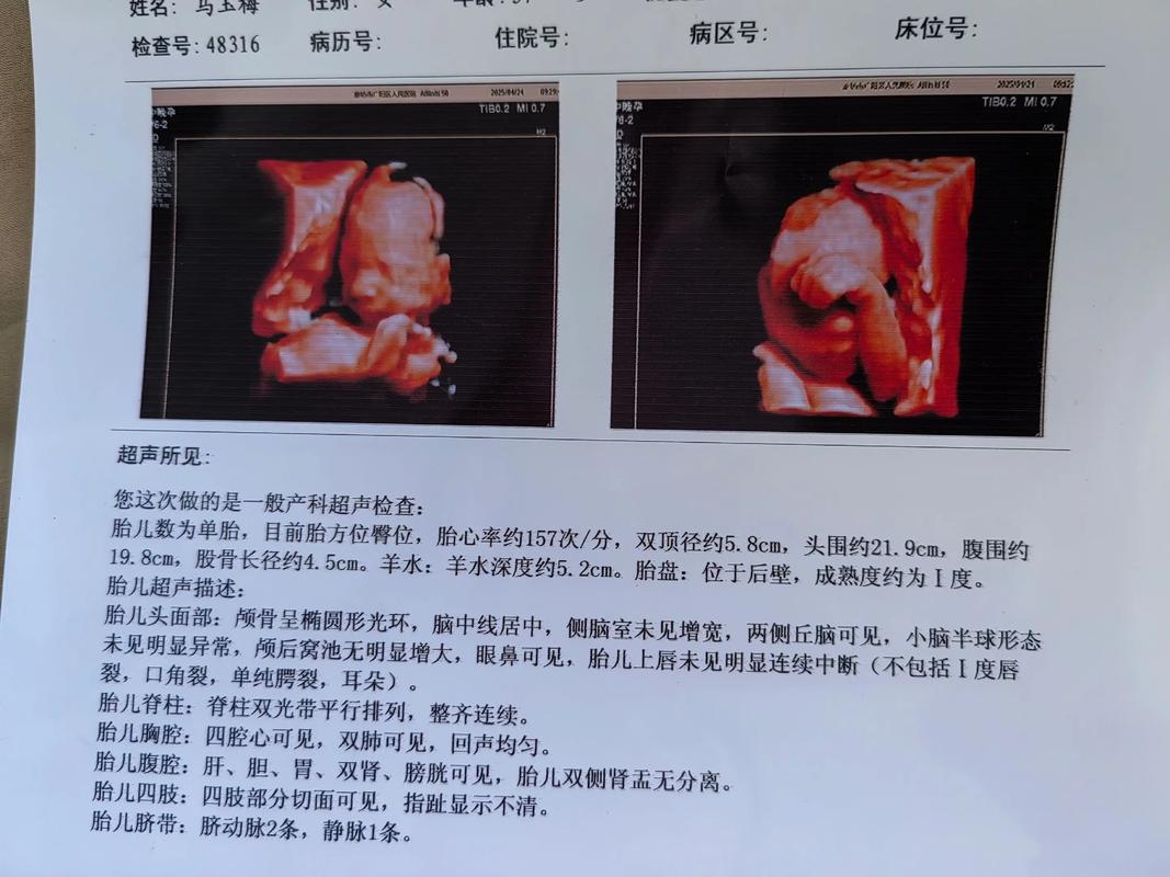 孕期三维彩超单怎么看-第3张图片-郑州医学网