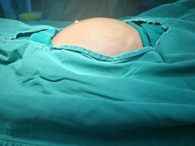 儿童便秘腹部摸到硬块是粪便堆积还是其他疾病信号？-第1张图片-郑州医学网