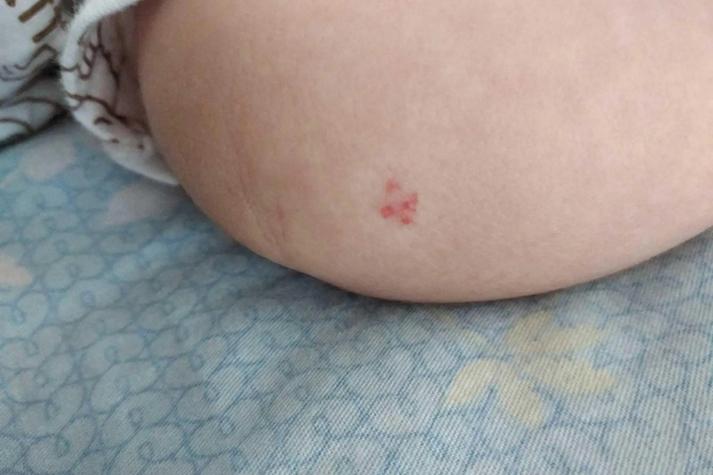 新生儿皮肤薄血管明显，是正常现象还是需要警惕的健康信号？-第1张图片-郑州医学网