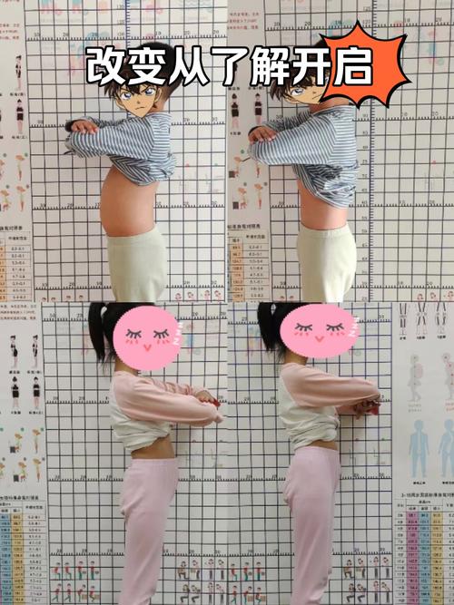 儿童骨盆前倾矫正方法有哪些？不同年龄段矫正方案有差异吗？-第1张图片-郑州医学网