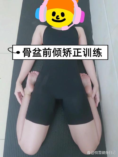 儿童骨盆前倾矫正方法有哪些？不同年龄段矫正方案有差异吗？-第2张图片-郑州医学网