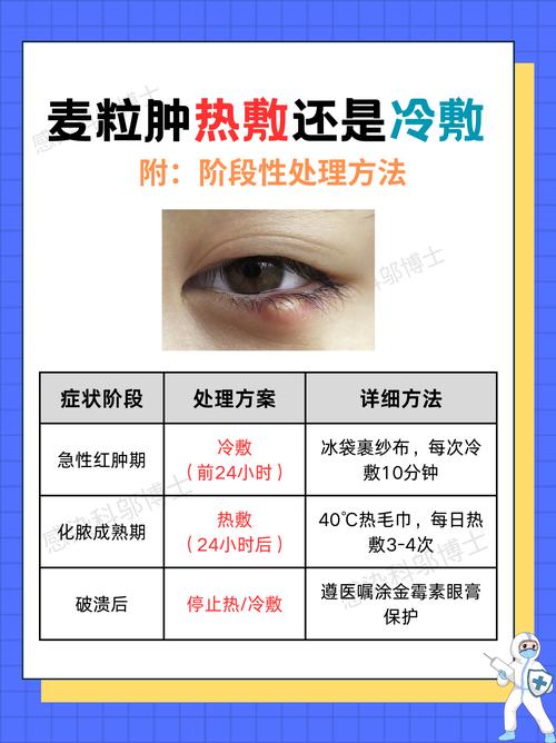 怀孕期间长了麦粒肿，能用药治疗吗？对胎儿有影响吗？-第2张图片-郑州医学网