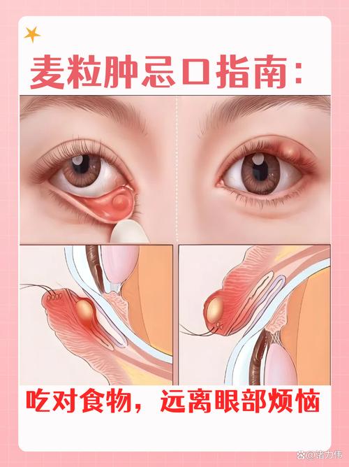 怀孕期间长了麦粒肿，能用药治疗吗？对胎儿有影响吗？-第1张图片-郑州医学网