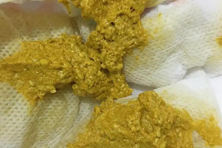 新生儿宝宝粑粑酸臭味-第3张图片-郑州医学网