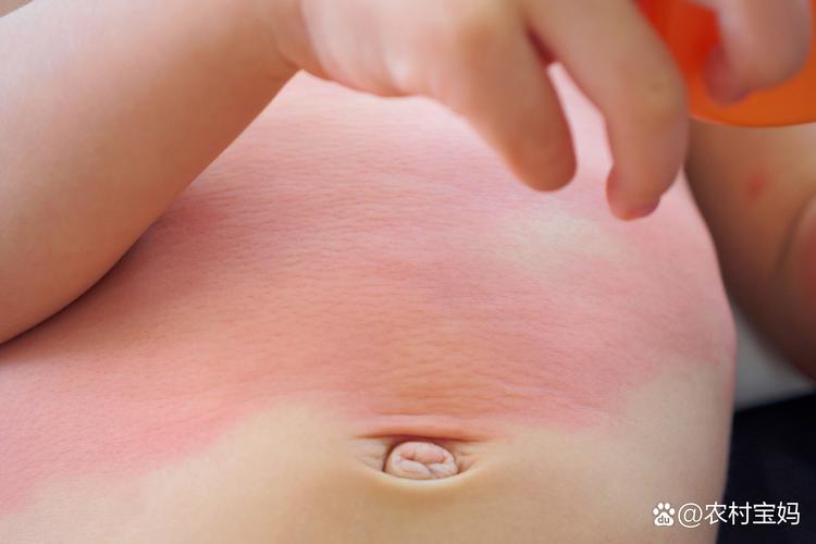 新生儿小茴香热敷肚子真能缓解胀气吗？正确方法和注意事项是什么？-第2张图片-郑州医学网