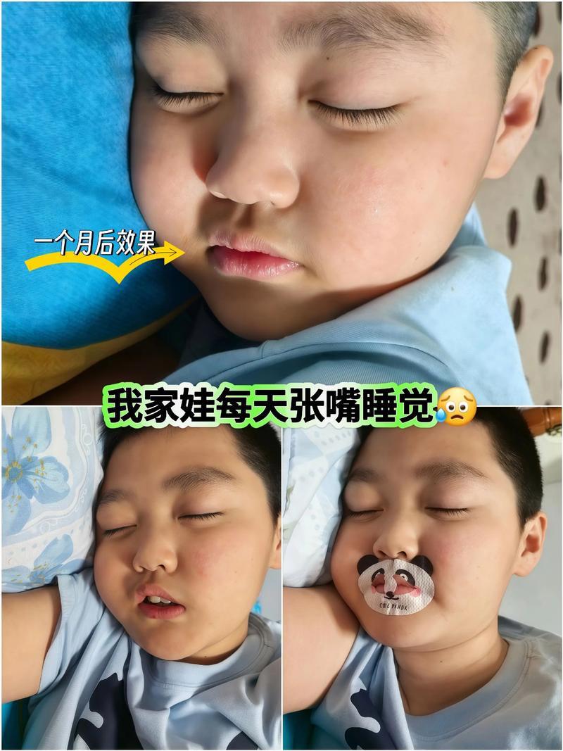 新生儿睡觉总是张着嘴-第2张图片-郑州医学网