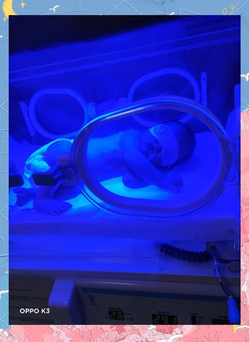 新生儿照蓝光到底要住院几天？不同情况天数差异大吗？-第2张图片-郑州医学网