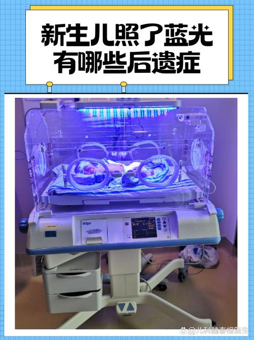 新生儿照蓝光到底要住院几天？不同情况天数差异大吗？-第1张图片-郑州医学网